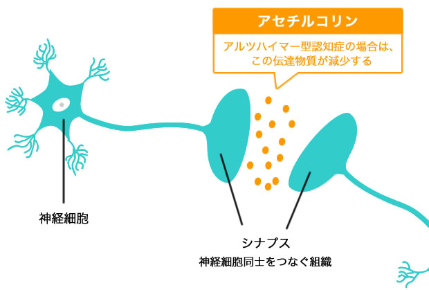 よく噛んで認知症予防を 神経細胞間の情報伝達