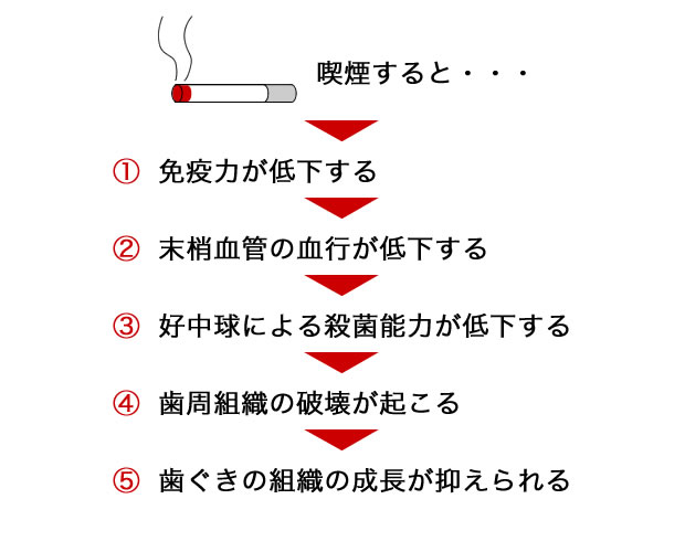 喫煙と歯周病の関係 Vol.02